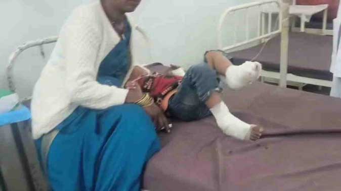 साइकिल रेस के दौरान दर्दनाक हादसा, पिकअप की टक्कर से बच्चे के पैर कुचले, अस्पताल में भर्ती